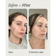 thumbnail image 3 of Faded Topicals Brightening & Clearing Serum, 3 of 5