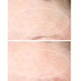 thumbnail image 4 of StriVectin SD Advanced PLUS Intensive Moisturizer for Wrinkles & Stretch Marks, 2 x 47 mL, 4 of 4