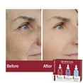 thumbnail image 2 of Skincyclopedia Intense Anti Aging Face Serum Treatment, Hyaluronic + Retinol + Matrixyl,  Age Refine Skin Routine, Deep Hydrator + Wrinkle Correction + Even Tone.  Dark Spot Skin Brightener., 2 of 6