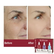 Skincyclopedia Intense Anti Aging Face Serum Treatment, Hyaluronic + Retinol + Matrixyl, Age Refine Skin Routine, Deep Hydrator + Wrinkle Correction + Even Tone. Dark Spot Skin Brightener.