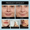 thumbnail image 3 of Paquete de 6 parches antiarrugas para el rostro. Reduce arrugas y líneas finas. Reutilizables. Adecuados para todo tipo de labios., 3 of 8