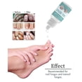 thumbnail image 5 of Fungal Nail Solution for Toenails - Fixes Discolored Nails, Safe & Effective - Anti Fungus Oil for Ingrown Toenails, 5 of 5