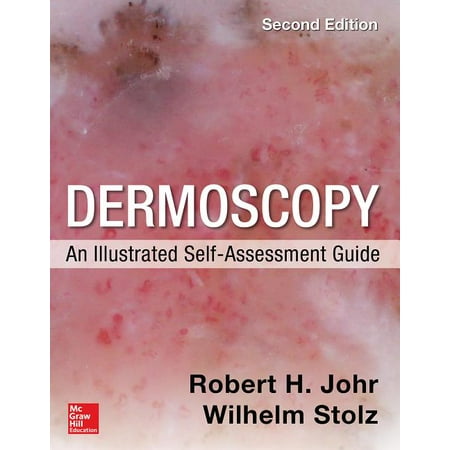 UPC: 9780071834346 | Dermoscopy: An Illustrated Self-Assessment Guide 2/E (Paperback)