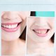 thumbnail image 5 of Teeth Whitening LED Light Portable Gentle Teeth Whitening Accelerator Light for Home White Central Control Cable Set, 5 of 5