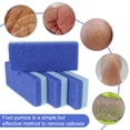thumbnail image 4 of Eummy Foot Pumice Stone Exfoliator Block Feet Hard Skin Callus Remover Scrubber Pedicure Foot Clean Tool, 4 of 10