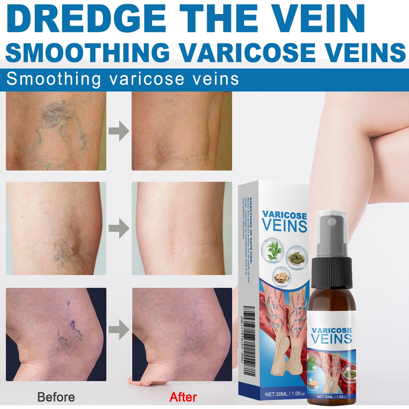 Alvantor Body Spray for Veins Leg Treatment with Herbal Formula, Relieves Tired Heavy Legs, 1.05oz