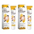 thumbnail image 1 of Vitiligo Treatments Cream Portable Anti-itch Body Care Cream For Skin Care, 1 of 5