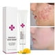thumbnail image 1 of Crema para el acné Crema antimanchas Crema para eliminar puntos negros Crema para reducir los poros Blanqueamiento Hidratante Cuidado de la piel del rostro, 1 of 10