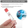 thumbnail image 4 of 100 Pcs Vacuum Tube Blood Collector Tubes Blood Collecting Tubes Tubes Lid Test Tubes Cover, 4 of 4