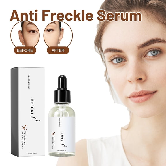 Gzwccvsn VitaminC Facial Serum Moisturizing And Freckle Removalwhiten And Antioxidant 30ML face, body skincare korean