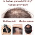 thumbnail image 5 of IBeaLee Black Sesame Hair Growth Liquid for Strong and Moisturizing Hair Roots, Improving Anti Hair Loss, Strengthening and Firming Hair, Essential Oil for Tightening Hair, 5 of 5