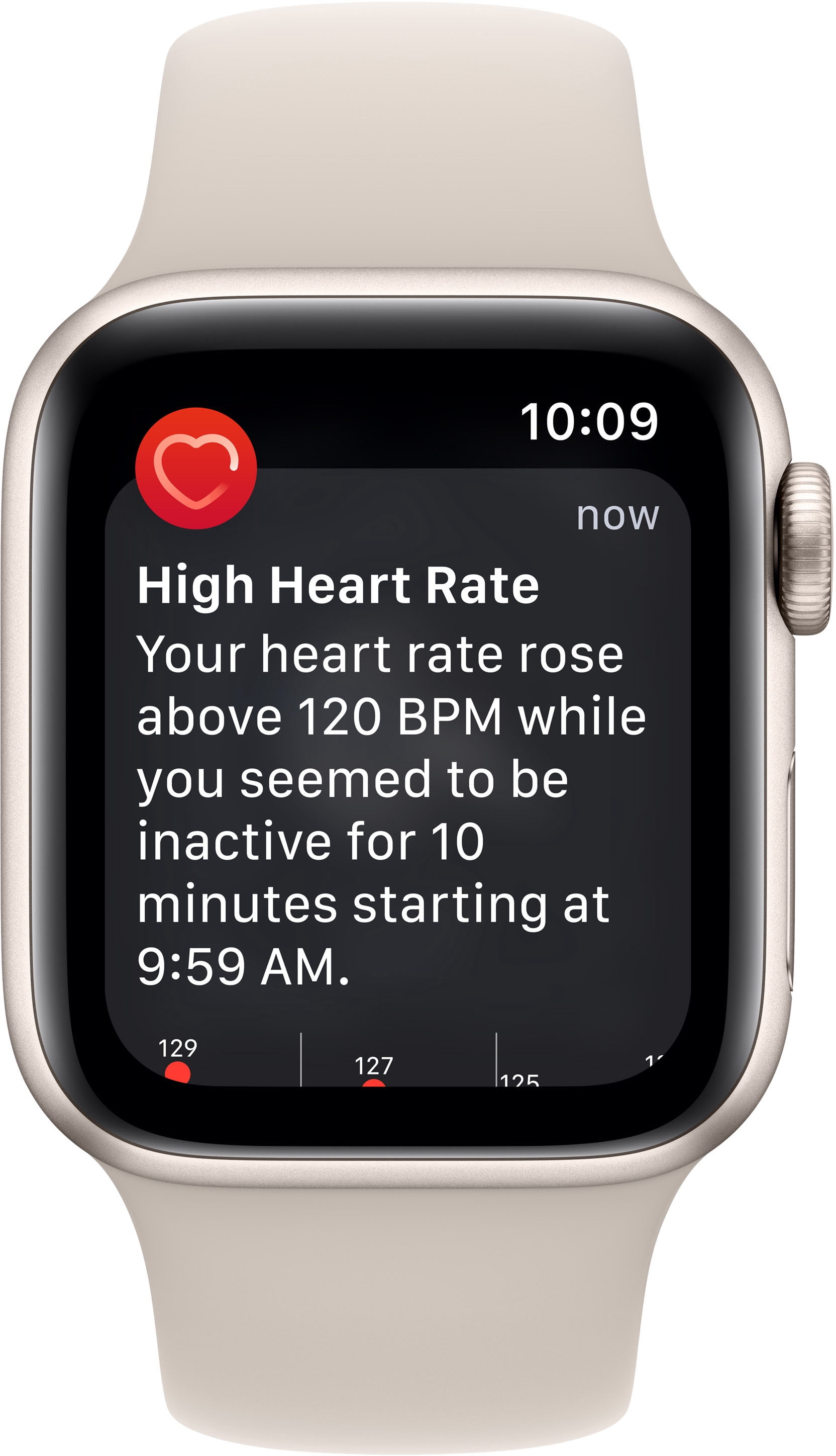 Restored Apple Watch SE 2nd Gen (GPS + Cellular) 40mm Starlight Aluminum (Refurbished)