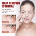 thumbnail image 2 of Anti-Puffiness Eye Serum for Dark Circles & Fat Granules 30ml, 2 of 5