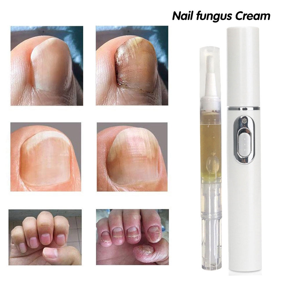 Buy Excilor Nail Anti Fungal Pen online at Cincotta Discount Chemist