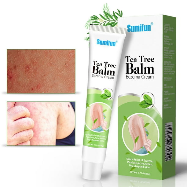 Cream for Itch Relief Anti Itch Cream with Pramoxine Hydrochloride