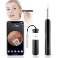 thumbnail image 1 of Wireless HD Ear Wax Remover Camera Ear Endoscope Spoon Pick Clean Tool LED Light, 1 of 5
