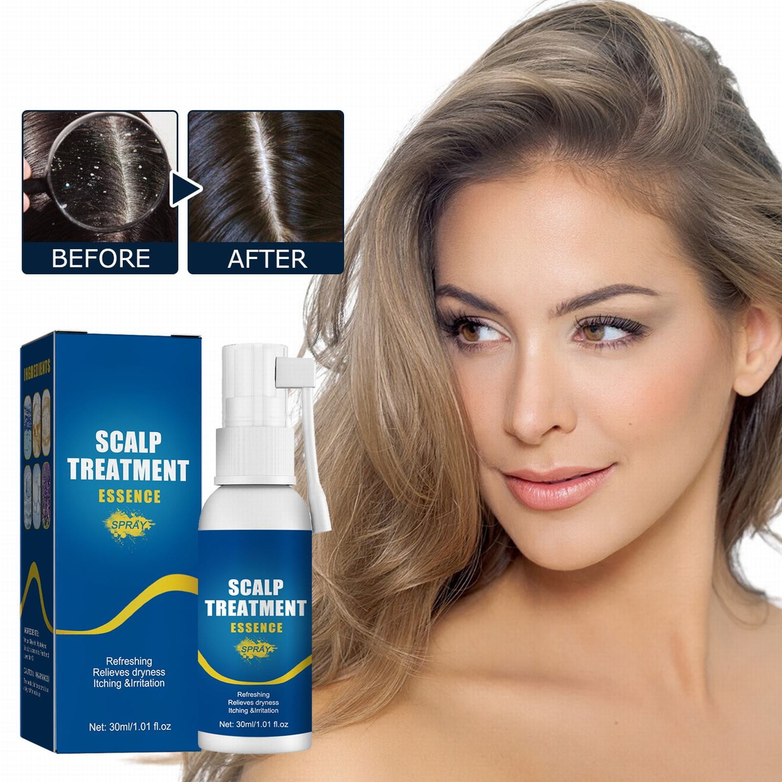 niuredltd organic scalp fast hair growth anti hair loss hair growth