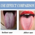 thumbnail image 3 of Raspador de lengua, raspador de lengua de acero inoxidable, elimina el mal aliento, cepillos de lengua para el cuidado bucal, 3 of 5