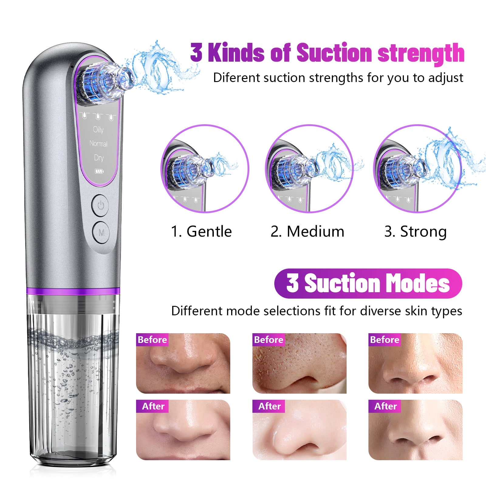 JUUTREN Blackhead Remover Pore Vacuum for Face, Water Cycle Facial  Pore Cleanser with 3 Suction Levels, 5 Heads for Deep Cleansing & Skin Care, Electric Facial Cleansing Tool for Women & Men
