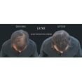thumbnail image 5 of LUXE Hair Thickening Fibers with Natural Keratin-2 Months+ Supply!-Confidence in a Jar! - Gray  - Multiple Colors Available, 5 of 14
