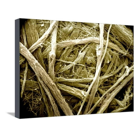 - Dense Connective Tissue, Irregular, with Collagen Fibers Stretched Canvas Print Wall Art By Richard Kessel