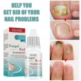 thumbnail image 1 of 1pc Fungal Nail Treatment Liquid Nail Repair Moisturizing Anti-bag Nursing Liquid, 1 of 5