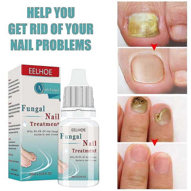 1pc Fungal Nail Treatment Liquid Nail Repair Moisturizing Anti-bag Nursing Liquid
