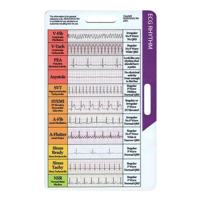 ECG/EKG Rhythms Pocket Card, Double-Sided Interpretation Guide for Nurses & Students, Quick Reference for Medical Professionals