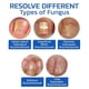 thumbnail image 4 of Dispositivo láser para hongos en las uñas, terapia de luz, onicomicosis, tratamiento de dedos de los pies, recargable, 4 of 5
