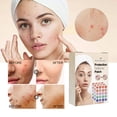 thumbnail image 1 of Large Capacity Pimple Patches, Colorful Cute Zit Covers,Hydrocolloid Acne Patches With Tea Oil, Witch Hazel, Centella Asiatica , Hyaluronic Sour, 1 of 4