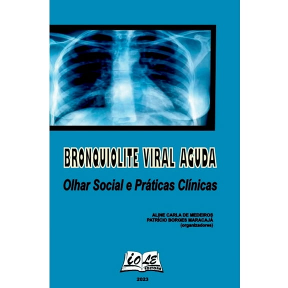 Bronquiolite Viral Aguda: Olhar Social E Práticas Clínicas, (Paperback)