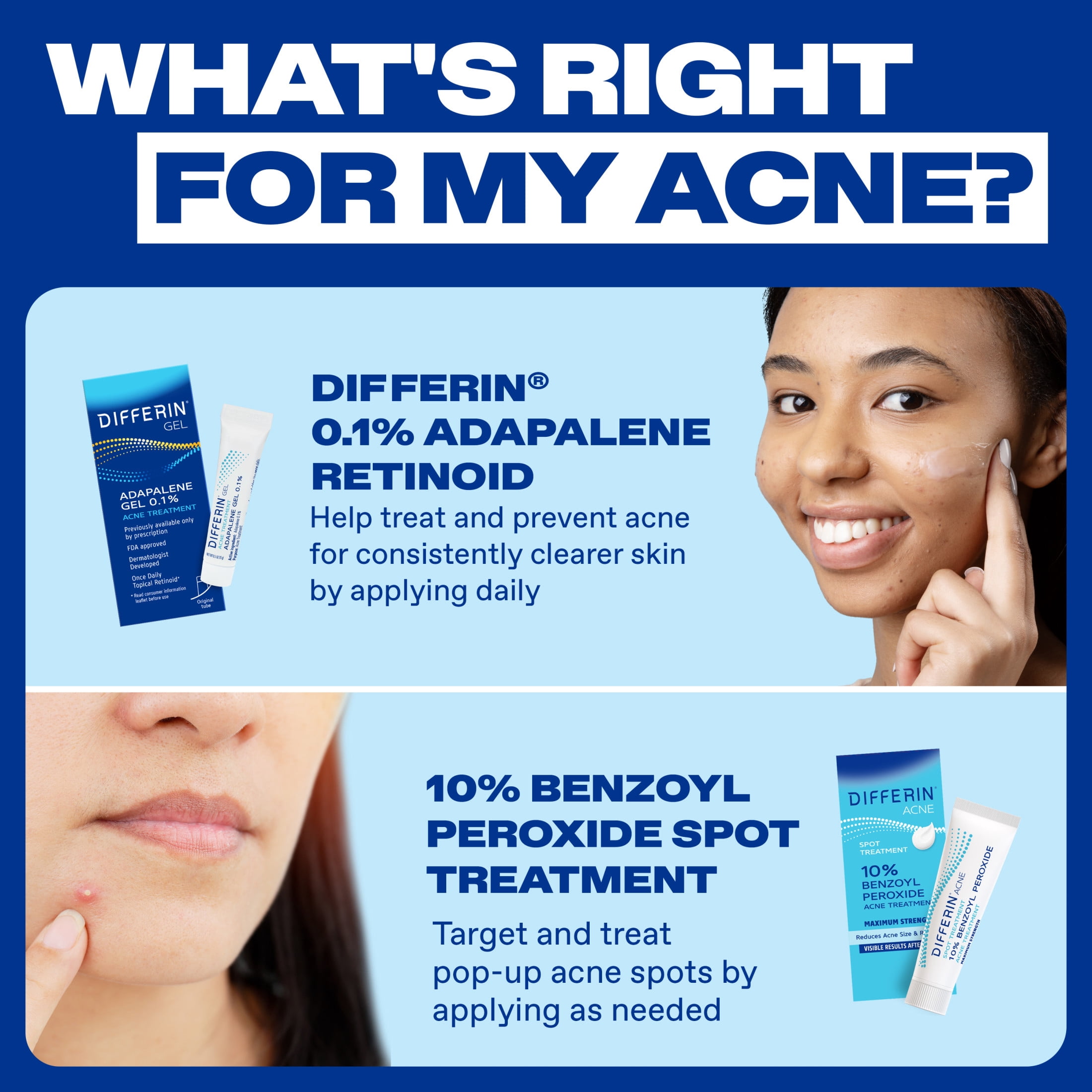 Differin Acne Spot Treatment with 10% Benzoyl Peroxide, Maximum Strength, Fast-Acting, Acne Treatment for Face & Body​, 1 oz