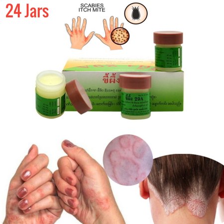 Natural Aid For Scabies, Psoriasis, Jock Itch, Ringworm, Herpes - Herbal, Antimicrobial, Anti-fungal Antiseptic - Fast Acting - 5 Year Shelf Life (24 Jars x 7.5g each)