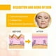 thumbnail image 4 of Parche antiarrugas para pliegues nasolabiales de Jaysuing, reduce líneas finas, hidratante, antienvejecimiento, reafirmante de la piel, parches de colágeno para líneas de sonrisa Xinda |, 4 of 4