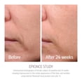 thumbnail image 3 of Crema Hidratante Epionce Renewal Loción Facial Antienvejecimiento, 3 of 9