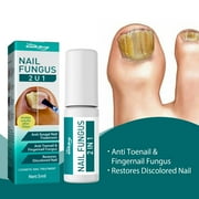 Kripyery 5ml Grey Finger Fluid Mild Ingredients Convenient Moderate Effective Fast Healing Health Caring Accessory Portable Nail Fungus Care Solution for Girl