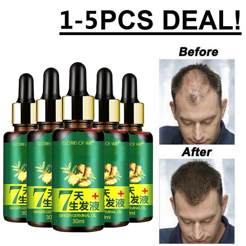 ReGrow 7 Day Ginger Hair Oil Germinal Growth Serum Hairdressing Loss ...
