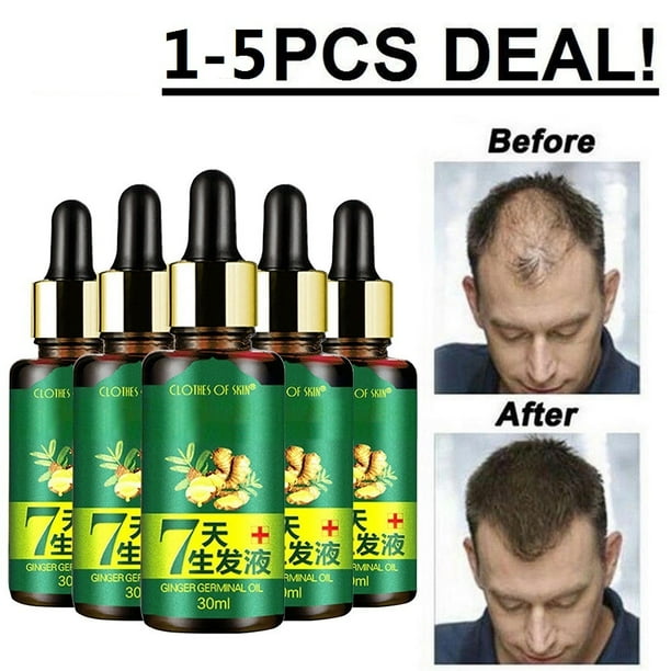 Regrow 7 Day Ginger Hair Oil Germinal Growth Serum Hairdressing Loss Treatment Walmart Com Walmart Com