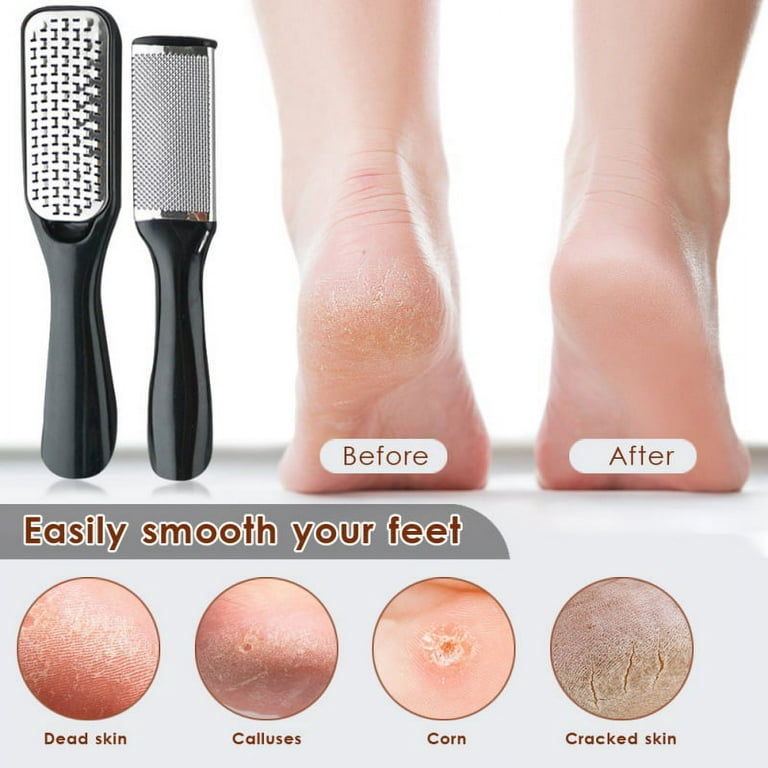 Pedicure Foot Care Tools Foot File Rasps Callus Dead Foot Skin Care Remover  Sets Stainless Steel