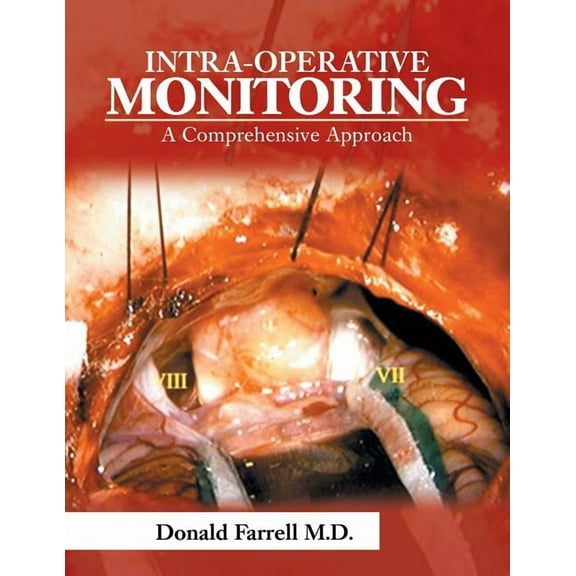 Intra-Operative Monitoring: A Comprehensive Approach, (Paperback)