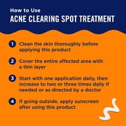 PanOxyl Acne Clearing Spot Treatment, 10% Benzoyl Peroxide, 1 oz