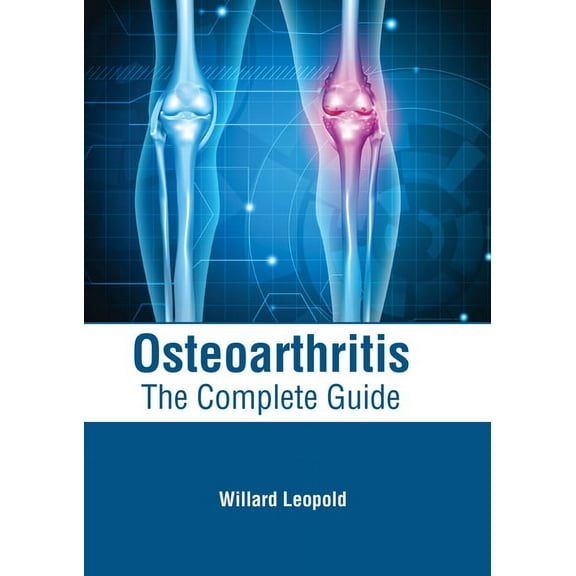 Osteoarthritis: The Complete Guide, (Hardcover)