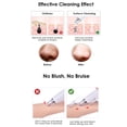 thumbnail image 2 of Blackhead Remover Ergonomic Electric Portable Pore Cleaner Blackhead Cleaner, 2 of 8