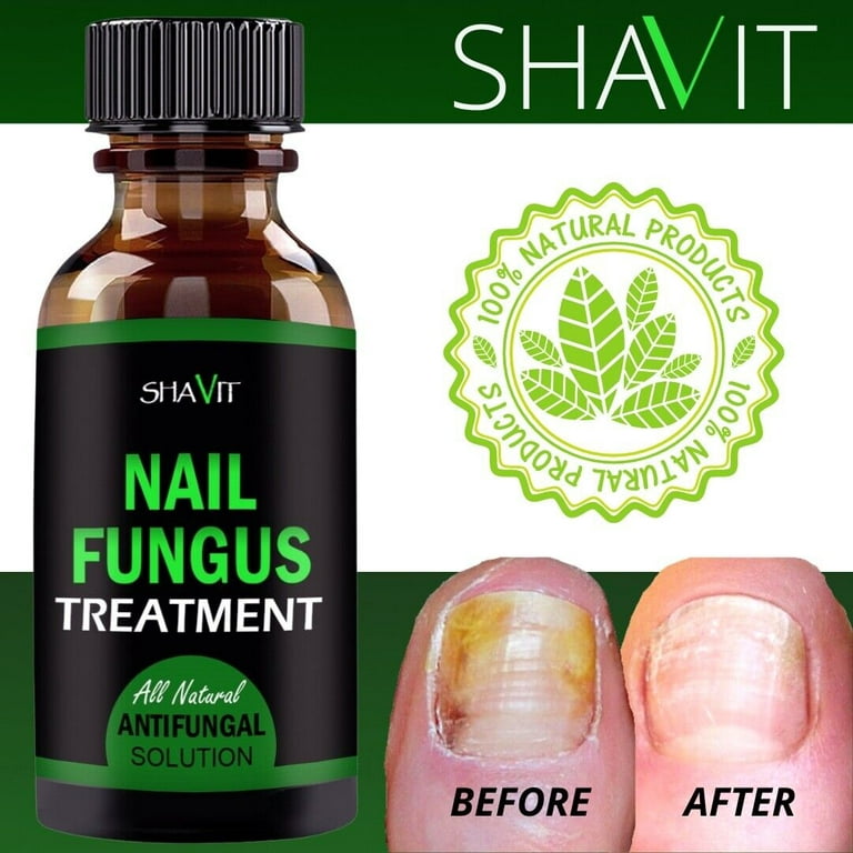 Antifungal foot care products for nail fungus