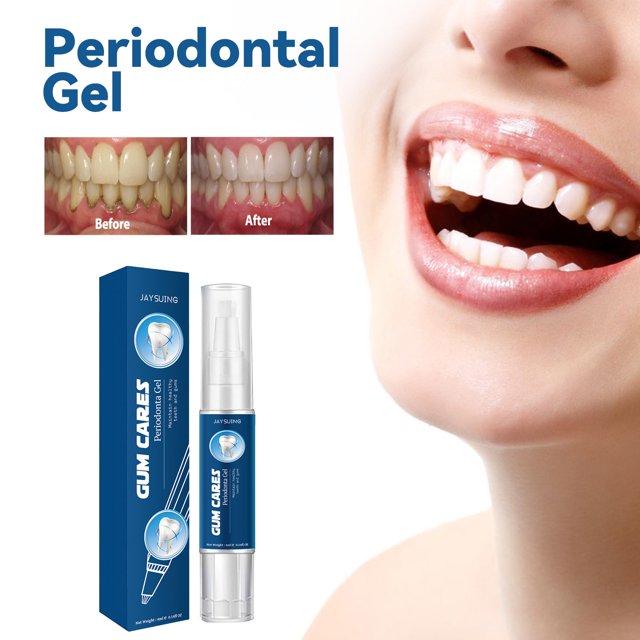 Puntoco Gel blanqueador de dientes para reducir las manchas amarillas y la suciedad. Agente calmante reparador de encías, 4 ml