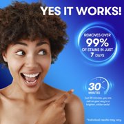 MySmile Teeth Whitening Strips for Sensitive Teeth , Hydroxyapatite-Infused, Enamel Safe & Non-Slip White Strips, Residue-Free, Yellow Teeth Stains Remover Whitening kit, 28pcs, Mint