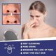 thumbnail image 3 of Jaysuing Deep Pore Cleansing Paste Deep Cleansing Nose Blackhead Closed Mouth Firming Pore Care Nasal Sticker - 6Pcs, 3 of 4