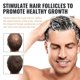 thumbnail image 4 of Champú antipérdida de cabello, reparación de rápido crecimiento, tratamiento del cuero cabelludo dañado, nutrición hidratante profunda, acondicionador seco para el crecimiento F T5D0, 4 of 5