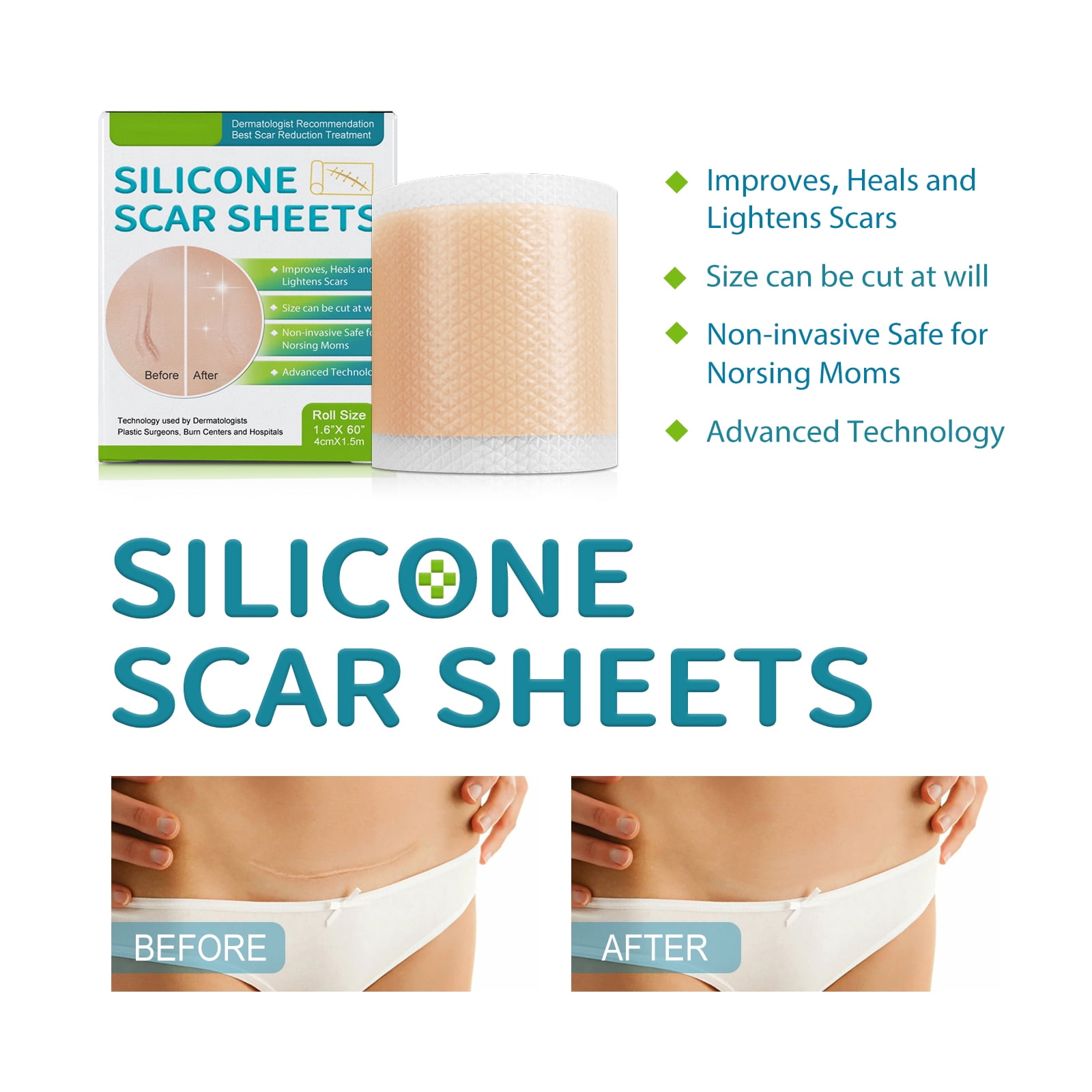 Alvantor Silicone Scar Sheets - Medical Grade Scar Tape Roll for C-Section, Surgery, Burn, Acne Scars Treatment, 1.6"*60"