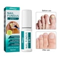 Travelwant 5ml Max Strength Nail Fungus Treatment Toe & Finger Fungal Nail Renewal, Health